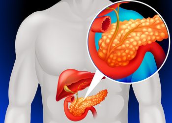 17 de noviembre: Día Mundial del Cáncer de Páncreas