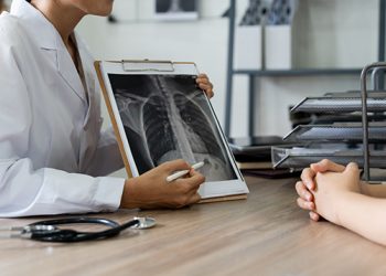 El diagnóstico temprano, aliado esencial contra el cáncer de pulmón