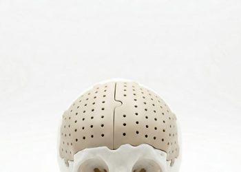 Tecnología a favor del paciente:la impresión 3D abre una nueva era en la medicina moderna.
