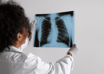 Hipertensión arterial pulmonar: una enfermedad rara y silenciosa que exige diagnóstico temprano y acceso a tratamiento médico