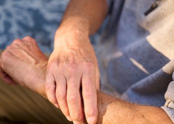 La esclerodermia  y el reto de identificar una enfermedad que avanza en silencio