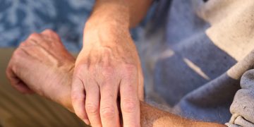 La esclerodermia  y el reto de identificar una enfermedad que avanza en silencio
